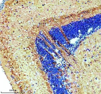 Zebrafish TUBA1A Antibody Brain IHC. Immunohistochemical staining of paraffin-embedded zebrafish brain tissue using Zebrafish TUBA1A Antibody / Alpha Tubulin Antibody demonstrates prominent cytoplasmic HRP-DAB brown staining throughout neural tissue compartments. The staining pattern is consistent with expression of Alpha Tubulin (TUBA1A), a highly conserved microtubule-associated protein that plays essential roles in neuronal differentiation, axonal extension, intracellular transport, and nervous system development. TUBA1A immunoreactivity highlights neuronal architecture and microtubule-rich cellular processes within the zebrafish brain, supporting its utility as a marker of cytoskeletal organization during neurodevelopment. Heat-mediated antigen retrieval was performed in EDTA buffer. Sections were blocked with 10% goat serum and incubated overnight at 4Â°C with 2 Âµg/ml primary antibody, followed by peroxidase-conjugated goat anti-rabbit IgG secondary antibody for 30 minutes at 37Â°C. Signal was visualized using DAB chromogen.
