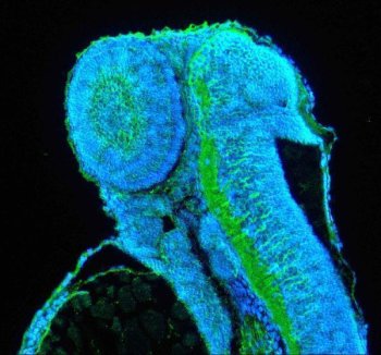 Zebrafish c-Jun Antibody Embryo IF. Immunofluorescent staining of paraffin-embedded zebrafish embryo tissue using Zebrafish c-Jun Antibody / JUN Antibody demonstrates distinct green fluorescence within developing embryonic and neural-associated tissue structures, consistent with expression of c-Jun (JUN), a member of the AP-1 family of transcription factors. c-Jun functions as a key regulator of gene expression involved in embryonic development, cellular differentiation, stress responses, and tissue regeneration. The staining pattern highlights regions of active developmental signaling and transcriptional regulation within the embryo, while DAPI (blue) counterstains cell nuclei. Heat-mediated antigen retrieval was performed in EDTA buffer. Sections were blocked with 10% goat serum and incubated overnight at 4Â°C with 5 Âµg/ml primary antibody, followed by DyLight 488-conjugated goat anti-rabbit IgG secondary antibody at 1:500 dilution for 30 minutes at 37Â°C.