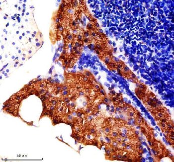 Zebrafish RPL8 Antibody Pancreas IHC. Immunohistochemical staining of paraffin-embedded zebrafish pancreas tissue using Zebrafish RPL8 Antibody / Ribosomal Protein L8 Antibody demonstrates strong cytoplasmic HRP-DAB brown staining throughout pancreatic epithelial and secretory cell populations. The staining pattern is consistent with expression of RPL8, a structural component of the 60S large ribosomal subunit that participates in protein synthesis and ribosome function. Robust cytoplasmic localization reflects the abundance of ribosomes within metabolically active pancreatic cells, supporting the essential role of RPL8 in translational activity, cellular growth, and maintenance of tissue function. Heat-mediated antigen retrieval was performed in EDTA buffer. Sections were blocked with 10% goat serum and incubated overnight at 4Â°C with 2 Âµg/ml primary antibody, followed by peroxidase-conjugated goat anti-rabbit IgG for 30 minutes at 37Â°C. DAB was used as the chromogenic substrate.