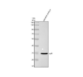Zebrafish RPL8 Antibody Embryo Western Blot. Western blot analysis of zebrafish embryo tissue lysate (lane 1) using Zebrafish RPL8 Antibody / Ribosomal Protein L8 Antibody demonstrates a distinct band at approximately 35 kDa, consistent with detection of RPL8. Ribosomal Protein L8 (RPL8) is a structural component of the 60S large ribosomal subunit that supports ribosome assembly, protein synthesis, and translational activity. As an essential component of the cellular protein production machinery, RPL8 contributes to embryonic growth, tissue development, and maintenance of cellular biosynthetic capacity. Detection of RPL8 in zebrafish embryo lysate is consistent with the high translational demands associated with embryogenesis and developmental gene expression programs. Electrophoresis was performed using a 10% SDS-PAGE gel under reducing conditions with 30 Âµg of protein loaded per lane. Signal was visualized using HRP-conjugated secondary antibody and ECL detection.
