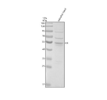 Zebrafish LCK Antibody WB. Western blot analysis of zebrafish head tissue lysate using Zebrafish LCK Antibody / Lymphocyte-Specific Protein Tyrosine Kinase Antibody demonstrates a distinct immunoreactive band at approximately 55-57 kDa, consistent with the predicted molecular weight of LCK. LCK is a Src family tyrosine kinase that plays a central role in T-cell receptor signaling, lymphocyte activation, immune cell development, and adaptive immune responses. As a key regulator of downstream signaling pathways in lymphoid cells, LCK is widely studied in immunology, hematopoiesis, and vertebrate developmental biology. Thirty micrograms of protein lysate were resolved under reducing conditions on a 10% SDS-PAGE gel and transferred to nitrocellulose prior to immunodetection. The observed band supports detection of zebrafish LCK by western blot analysis. Predicted molecular weight: ~57 kDa.