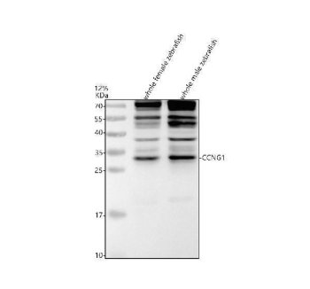 Zebrafish Cyclin G1 Antibody WB. Western blot analysis of whole female zebrafish tissue lysate (lane 1) and whole male zebrafish tissue lysate (lane 2) using Zebrafish Cyclin G1 Antibody / CCNG1 Antibody demonstrates a prominent band at approximately 34 kDa, consistent with the reported molecular weight of full-length Cyclin G1 (CCNG1). Cyclin G1 is a member of the cyclin family that functions in cell cycle-associated signaling pathways, cellular growth control, and p53-responsive regulatory networks. CCNG1 contributes to mechanisms that coordinate cellular proliferation, checkpoint regulation, and adaptation to developmental and environmental stimuli. Additional higher molecular weight bands are also observed and may reflect Cyclin G1-associated protein complexes, modified protein species, or other factors that influence electrophoretic migration. Electrophoresis was performed on a 12% SDS-PAGE gel under reducing conditions with 30 Âµg of protein loaded per lane, followed by nitrocellulose transfer and HRP-ECL detection.