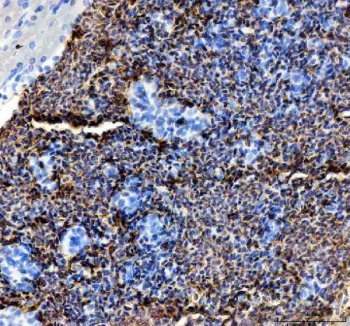 Zebrafish SLC4A1 Antibody Spleen IHC. Immunohistochemical staining of paraffin-embedded zebrafish spleen tissue using Zebrafish SLC4A1 Antibody / SLC4A1A Antibody demonstrates strong HRP-DAB brown staining throughout erythrocyte-rich cellular populations within splenic tissue. The staining pattern is consistent with expression of SLC4A1A, the zebrafish ortholog of human SLC4A1 (Band 3/AE1), a chloride/bicarbonate exchanger that plays a critical role in erythrocyte membrane function, carbon dioxide transport, and acid-base regulation. SLC4A1A is highly associated with erythroid cells and contributes to maintenance of red blood cell membrane integrity and physiologic ion transport. The prominent splenic staining is consistent with the role of the spleen as a major hematopoietic and blood cell-associated organ in teleost fish. Heat-mediated antigen retrieval was performed in EDTA buffer prior to overnight primary antibody incubation and HRP-DAB visualization.