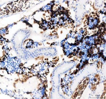 Zebrafish SLC4A1 Antibody Kidney IHC. Immunohistochemical staining of paraffin-embedded zebrafish kidney tissue using Zebrafish SLC4A1 Antibody / SLC4A1A Antibody demonstrates strong HRP-DAB brown staining within erythrocyte-rich cellular populations distributed throughout the renal hematopoietic compartment. The staining pattern is consistent with expression of SLC4A1A, the zebrafish ortholog of human SLC4A1 (Band 3/AE1), a chloride/bicarbonate exchanger that plays an essential role in erythrocyte membrane function, carbon dioxide transport, and acid-base regulation. SLC4A1A is highly associated with erythroid cells and contributes to maintenance of red blood cell membrane integrity and physiologic ion transport. The prominent staining observed within blood cell-rich regions of the zebrafish kidney is consistent with the role of the teleost kidney as a major hematopoietic organ involved in erythropoiesis and blood cell maintenance. Heat-mediated antigen retrieval was performed in EDTA buffer prior to overnight primary antibody incubation and HRP-DAB visualization.