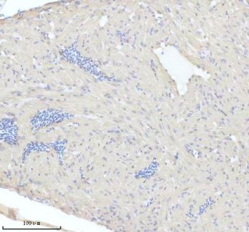 Zebrafish MYL7 Antibody Cardiac Muscle IHC. Immunohistochemical staining of paraffin-embedded zebrafish heart tissue using Zebrafish MYL7 Antibody / Myosin Light Chain 7 Antibody demonstrates low-level cytoplasmic HRP-DAB brown staining within cardiac muscle tissue. MYL7 is a myosin light chain family member that functions within the cardiac contractile apparatus and contributes to regulation of actomyosin interactions, sarcomere organization, and myocardial contraction. In zebrafish, MYL7 is widely used as a marker of cardiomyocyte differentiation and heart development due to its association with developing and mature cardiac muscle cells. The observed staining pattern is consistent with expression of a contractile protein involved in cardiac muscle structure and function. Heat-mediated antigen retrieval was performed in EDTA buffer prior to overnight primary antibody incubation and HRP-DAB visualization.