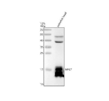Zebrafish MYL7 Antibody WB. Western blot analysis of zebrafish head tissue lysate using Zebrafish MYL7 Antibody / Myosin Light Chain 7 Antibody demonstrates a prominent band at approximately 17 kDa, consistent with the expected molecular weight of MYL7. Myosin Light Chain 7 (MYL7) is a contractile protein that forms part of the myosin motor complex and contributes to regulation of actomyosin interactions, sarcomere organization, and muscle contraction. In zebrafish, MYL7 is widely recognized as a marker of cardiac muscle differentiation and heart development, reflecting its association with cardiomyocyte function and myocardial maturation. The observed band confirms detection of MYL7 and supports the utility of this antibody for studies of cardiac development, muscle biology, and contractile protein expression. Additional faint higher molecular weight bands may represent myosin-associated protein complexes, post-translationally modified protein species, or other factors influencing electrophoretic migration. Electrophoresis was performed on a 12% SDS-PAGE gel under reducing conditions with 30 Âµg of protein loaded per lane, followed by nitrocellulose transfer and HRP-ECL detection.