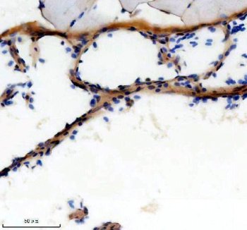 Zebrafish TBX1 Antibody Heart IHC. Immunohistochemical staining of paraffin-embedded zebrafish heart tissue using Zebrafish TBX1 Antibody / T-Box Transcription Factor TBX1 Antibody demonstrates distinct HRP-DAB brown staining within cardiac-associated tissue structures. TBX1 is a T-box family transcription factor that regulates developmental gene expression programs involved in embryonic patterning, tissue specification, and organogenesis. In zebrafish and other vertebrates, TBX1 plays important roles in cardiovascular development, pharyngeal arch formation, and morphogenesis of embryonic tissues. The observed staining pattern is consistent with expression of a developmental transcription factor associated with cardiac and cardiovascular development. Heat-mediated antigen retrieval was performed in EDTA buffer prior to overnight primary antibody incubation and HRP-DAB visualization.