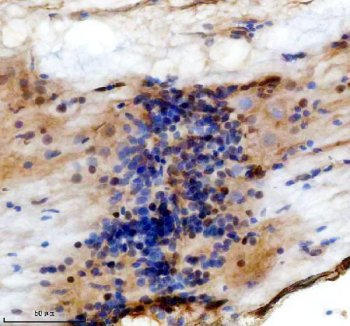 Zebrafish TBX1 Antibody Spinal Cord IHC. Immunohistochemical staining of paraffin-embedded zebrafish spinal cord tissue using Zebrafish TBX1 Antibody / T-Box Transcription Factor TBX1 Antibody demonstrates HRP-DAB brown staining within cells and tissue structures surrounding the developing spinal cord. TBX1 is a T-box family transcription factor that regulates developmental gene expression programs involved in embryonic patterning, tissue specification, and organogenesis. During vertebrate development, TBX1 participates in genetic networks that influence formation of multiple organ systems and contributes to processes governing tissue morphogenesis and cellular differentiation. The observed staining pattern is consistent with expression of a developmental transcription factor associated with embryonic tissue organization and neurodevelopmental processes. Heat-mediated antigen retrieval was performed in EDTA buffer prior to overnight primary antibody incubation and HRP-DAB visualization.