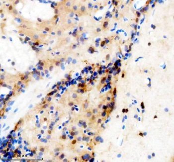 Zebrafish TBX1 Antibody Brain IHC. Immunohistochemical staining of paraffin-embedded zebrafish brain tissue using Zebrafish TBX1 Antibody / T-Box Transcription Factor TBX1 Antibody demonstrates HRP-DAB brown staining within neural tissue and brain-associated cellular populations. TBX1 is a T-box family transcription factor that regulates developmental gene expression programs involved in embryonic patterning, tissue specification, and organogenesis. During vertebrate development, TBX1 participates in genetic networks that coordinate formation of multiple organ systems and contributes to cellular differentiation and tissue morphogenesis. The observed staining pattern is consistent with expression of a developmental transcription factor associated with neural development and embryonic tissue organization. Heat-mediated antigen retrieval was performed in EDTA buffer prior to overnight primary antibody incubation and HRP-DAB visualization.