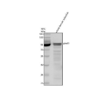 Zebrafish PIWIL1 Antibody WB. Western blot analysis of whole female zebrafish tissue lysate using Zebrafish PIWIL1 Antibody / Piwi-like Protein 1 Antibody demonstrates a prominent immunoreactive band at approximately 97 kDa. PIWIL1 (Ziwi) is a member of the PIWI subfamily of Argonaute proteins and is a key regulator of germ cell development, piRNA-mediated gene silencing, transposon suppression, and genome stability in zebrafish. Expression of PIWIL1 is closely associated with germline cell populations and reproductive tissues, making it an important marker for studies of developmental and reproductive biology. Thirty micrograms of protein lysate were resolved under reducing conditions on a 10% SDS-PAGE gel and transferred to nitrocellulose prior to immunodetection. The observed band supports detection of PIWIL1 in zebrafish tissue lysates by western blot analysis. Predicted molecular weight: ~97 kDa.