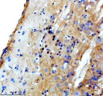 Zebrafish LHX3 Antibody Brain IHC. Immunohistochemistry staining of paraffin-embedded zebrafish brain tissue using Zebrafish LHX3 Antibody / LIM Homeobox Protein 3 Antibody demonstrates predominantly nuclear HRP-DAB brown staining within discrete neuronal cell populations. The staining pattern is consistent with expression of LHX3, a LIM-homeodomain transcription factor that regulates neuronal specification, motor neuron development, pituitary organogenesis, and embryonic patterning. LHX3 functions as a developmental transcriptional regulator controlling gene expression programs required for nervous system formation and cellular differentiation, making it an important marker for studies of neurodevelopment and vertebrate embryogenesis. HIER was performed using EDTA buffer. Tissue sections were blocked with 10% goat serum and incubated with primary antibody at 2 ug/ml overnight at 4Â°C prior to detection with HRP-conjugated secondary antibody and DAB chromogen.