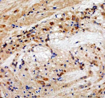 Zebrafish HSP90AA1 Antibody Brain IHC. Immunohistochemistry staining of paraffin-embedded zebrafish brain tissue using Zebrafish HSP90AA1 Antibody / Heat Shock Protein 90 Alpha Antibody demonstrates widespread cytoplasmic HRP-DAB brown staining within neural tissue-associated cellular populations. The staining pattern is consistent with expression of HSP90A, a highly conserved molecular chaperone orthologous to human HSP90AA1 (heat shock protein 90 alpha family class A member 1). HSP90A functions in protein folding, stabilization of signaling proteins, cellular stress responses, and maintenance of proteostasis, making it an important regulator of neuronal homeostasis and developmental signaling pathways. HIER was performed in pH 8.0 EDTA buffer. Tissue sections were blocked with 10% goat serum and incubated with primary antibody at 2 ug/ml overnight at 4Â°C prior to detection with HRP-conjugated secondary antibody and DAB chromogen.