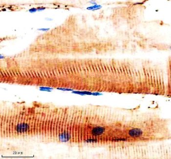 Zebrafish HSP90AA1 Antibody Muscle IHC. Immunohistochemistry staining of paraffin-embedded zebrafish muscle tissue using Zebrafish HSP90AA1 Antibody / Heat Shock Protein 90 Alpha Antibody demonstrates strong cytoplasmic HRP-DAB brown staining within striated muscle fibers. The staining pattern is consistent with expression of HSP90A, a highly conserved molecular chaperone orthologous to human HSP90AA1 (heat shock protein 90 alpha family class A member 1). HSP90A functions in protein folding, stabilization of signaling proteins, maintenance of proteostasis, and cellular responses to physiological and environmental stress. The prominent staining observed within muscle fibers is consistent with the substantial protein quality control and metabolic demands of contractile tissues. HIER was performed in pH 8.0 EDTA buffer. Tissue sections were blocked with 10% goat serum and incubated with primary antibody at 2 ug/ml overnight at 4Â°C prior to detection with HRP-conjugated secondary antibody and DAB chromogen.