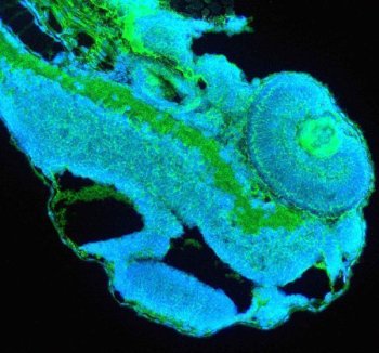 Zebrafish CDH17 Antibody IF. Immunofluorescent staining of paraffin-embedded zebrafish embryo tissue using Zebrafish CDH17 Antibody / Cadherin-17 Antibody demonstrates green fluorescence within developing epithelial and embryonic tissue compartments. The staining pattern is consistent with expression of CDH17 (Cadherin-17), a calcium-dependent cell adhesion molecule involved in epithelial organization, tissue integrity, and digestive tract development. CDH17 is widely used as a marker of intestinal epithelial differentiation and gastrointestinal organogenesis in zebrafish and other vertebrate model systems. HIER was performed using EDTA buffer prior to staining. Tissue sections were blocked with 10% goat serum and incubated with primary antibody at 5 ug/ml overnight at 4C. DyLight-488-conjugated goat anti-rabbit IgG was used as the secondary antibody (green), and nuclei were counterstained with DAPI (blue). The image supports detection of CDH17 expression in developing zebrafish embryonic tissues by immunofluorescence.