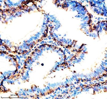 Zebrafish CDH17 Antibody Colon IHC. Immunohistochemistry staining of paraffin-embedded zebrafish colon tissue using Zebrafish CDH17 Antibody / Cadherin-17 Antibody demonstrates strong membranous and cytoplasmic HRP-DAB brown staining within intestinal epithelial cells lining glandular and luminal structures. The staining pattern is consistent with expression of CDH17 (Cadherin-17), a calcium-dependent cell adhesion molecule involved in epithelial organization, maintenance of tissue integrity, and gastrointestinal tract development. CDH17 is widely recognized as a marker of intestinal epithelial differentiation and digestive system maturation in zebrafish. HIER was performed using EDTA buffer. Tissue sections were blocked with 10% goat serum and incubated with primary antibody at 2 ug/ml overnight at 4C prior to detection with peroxidase-conjugated goat anti-rabbit IgG and DAB chromogen.