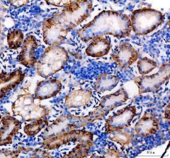 Zebrafish CDH17 Antibody Kidney IHC. Immunohistochemistry staining of paraffin-embedded zebrafish kidney tissue using Zebrafish CDH17 Antibody / Cadherin-17 Antibody demonstrates strong membranous and apical HRP-DAB brown staining within epithelial cells lining renal tubular structures. The staining pattern is consistent with expression of CDH17 (Cadherin-17), a calcium-dependent cell adhesion molecule that contributes to epithelial organization, maintenance of tissue architecture, and regulation of cell-cell adhesion. CDH17 is widely studied as an epithelial marker and plays important roles in tissue differentiation and organ development. HIER was performed using EDTA buffer. Tissue sections were blocked with 10% goat serum and incubated with primary antibody at 2 ug/ml overnight at 4C prior to detection with peroxidase-conjugated goat anti-rabbit IgG and DAB chromogen.