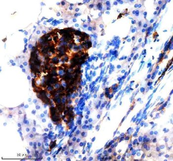Zebrafish JAG1 Antibody Pancreas IHC. Immunohistochemistry staining of paraffin-embedded zebrafish pancreas tissue using Zebrafish JAG1 Antibody / Jagged 1b Antibody demonstrates strong HRP-DAB brown staining within a discrete cluster of pancreatic cells. The staining pattern is consistent with expression of JAG1B, a transmembrane Notch ligand that regulates cell-cell communication, cellular differentiation, and tissue patterning during vertebrate development. JAG1B-mediated Notch signaling plays important roles in pancreatic development, maintenance of progenitor cell populations, and regulation of cell fate decisions within developing tissues. HIER was performed using EDTA buffer. Tissue sections were blocked with 10% goat serum and incubated with primary antibody at 2 ug/ml overnight at 4C prior to detection with peroxidase-conjugated goat anti-rabbit IgG and DAB chromogen.