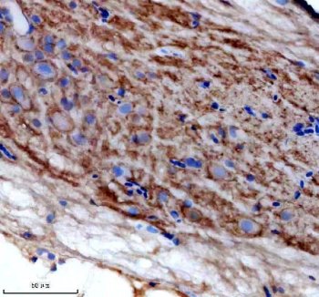 Zebrafish BCL2L1 Antibody Spinal Cord IHC. Immunohistochemistry staining of paraffin-embedded zebrafish spinal cord tissue using Zebrafish BCL2L1 Antibody / Bcl-XL Antibody demonstrates diffuse cytoplasmic HRP-DAB brown staining within spinal cord-associated neural cells. The staining pattern is consistent with expression of BCL2L1 (Bcl-XL), an anti-apoptotic member of the BCL2 protein family that promotes cell survival by inhibiting mitochondrial apoptosis pathways. BCL2L1 plays important roles in neuronal survival, embryonic development, tissue homeostasis, and regulation of programmed cell death. HIER was performed using EDTA buffer prior to staining. Tissue sections were blocked with 10% goat serum and incubated with primary antibody at 2 ug/ml overnight at 4C before detection with peroxidase-conjugated goat anti-rabbit IgG and DAB chromogen.
