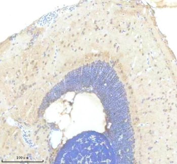 Zebrafish FOXC1 Antibody Brain IHC. Immunohistochemistry staining of paraffin-embedded zebrafish brain tissue using Zebrafish FOXC1 Antibody / Forkhead Box C1A Antibody demonstrates nuclear and perinuclear HRP-DAB brown staining within discrete neural cell populations. The staining pattern is consistent with expression of FOXC1A, a forkhead box transcription factor that regulates gene expression programs involved in embryonic development, neural crest biology, tissue patterning, and morphogenesis. FOXC1A plays important roles in vertebrate nervous system development and contributes to transcriptional networks that govern cellular differentiation and tissue organization. HIER was performed using EDTA buffer prior to staining. Tissue sections were blocked with 10% goat serum and incubated with primary antibody at 2 ug/ml overnight at 4C before detection with peroxidase-conjugated goat anti-rabbit IgG and DAB chromogen.