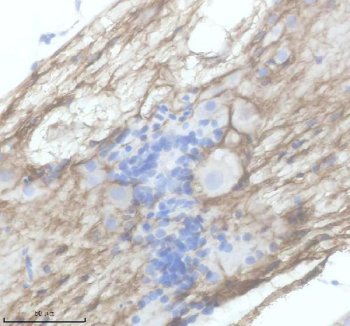 Zebrafish PDGFRA Antibody Spinal Cord IHC. Immunohistochemistry staining of paraffin-embedded zebrafish spinal cord tissue using Zebrafish PDGFRA Antibody / PDGFR Alpha Antibody demonstrates membranous and cytoplasmic HRP-DAB brown staining within spinal cord-associated cellular populations. The staining pattern is consistent with expression of PDGFRA, a receptor tyrosine kinase that mediates platelet-derived growth factor signaling and regulates cellular proliferation, migration, survival, and differentiation during vertebrate development. PDGFRA plays important roles in neural crest biology, mesenchymal tissue development, and organization of the developing nervous system. HIER was performed using EDTA buffer prior to staining. Tissue sections were blocked with 10% goat serum and incubated with primary antibody at 2 ug/ml overnight at 4C before detection with peroxidase-conjugated goat anti-rabbit IgG and DAB chromogen.