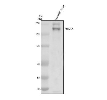 Zebrafish MRC1 Antibody Head WB. Western blot analysis of zebrafish head tissue lysate using Zebrafish MRC1 Antibody / Mannose Receptor Antibody. A distinct immunoreactive band is detected at approximately 165 kDa, consistent with the expected molecular weight of MRC1A (Mannose Receptor 1A). MRC1A is a C-type lectin receptor involved in carbohydrate recognition, receptor-mediated endocytosis, pathogen sensing, and innate immune regulation. The observed high molecular weight band is characteristic of the heavily glycosylated mannose receptor protein and supports detection of endogenous MRC1A expression in zebrafish tissue. Electrophoresis was performed on an 8% SDS-PAGE gel under reducing conditions using zebrafish head lysate. Membranes were blocked with 5% non-fat milk/TBS and incubated with rabbit anti-MRC1A antibody at 0.5 ug/ml overnight at 4Â°C, followed by goat anti-rabbit IgG-HRP secondary antibody and ECL detection using the Tanon 5200 imaging system. Predicted molecular weight: ~163 kDa. Observed molecular weight: ~165 kDa.