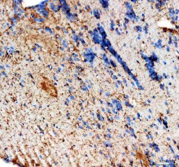 Zebrafish HMGCS1 Antibody Brain IHC. Immunohistochemical analysis of paraffin-embedded zebrafish brain tissue using Zebrafish HMGCS1 Antibody / HMG-CoA Synthase 1 Antibody demonstrates widespread cytoplasmic HRP-DAB brown staining throughout neural tissue. The staining pattern is consistent with expression of HMGCS1, a key enzyme of the mevalonate pathway that catalyzes an early step in cholesterol and isoprenoid biosynthesis. Positive immunoreactivity within the brain is consistent with the essential requirement for cholesterol metabolism and membrane synthesis in neuronal development, cellular signaling, and maintenance of nervous system function. Heat-induced antigen retrieval was performed in EDTA buffer. Tissue sections were blocked with 10% goat serum and incubated with HMGCS1 antibody (2 ug/ml) overnight at 4Â°C, followed by Peroxidase Conjugated Goat Anti-rabbit IgG and DAB chromogen detection.