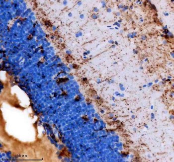 Zebrafish P0 Antibody Brain IHC. Immunohistochemical analysis of paraffin-embedded zebrafish brain tissue using Zebrafish P0 Antibody / MPZ Antibody demonstrates strong HRP-DAB brown staining within fiber-rich neural regions adjacent to densely cellular neuronal layers. The staining pattern is consistent with expression of P0 (Myelin Protein Zero), the principal structural protein of peripheral myelin that mediates myelin membrane adhesion and supports normal nerve conduction. Positive immunoreactivity is associated with myelinated neural processes and regions involved in nervous system organization, highlighting the role of MPZ in myelin sheath formation and maintenance. Heat-induced antigen retrieval was performed in EDTA buffer. Tissue sections were blocked with 10% goat serum and incubated with P0/MPZ antibody (2 ug/ml) overnight at 4Â°C, followed by Peroxidase Conjugated Goat Anti-rabbit IgG and DAB chromogen detection.