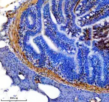 Zebrafish TPM1 Antibody Colon IHC. Immunohistochemical analysis of paraffin-embedded zebrafish colon tissue using Zebrafish TPM1 Antibody / Tropomyosin Alpha-1 Chain Antibody demonstrates strong HRP-DAB brown staining within the smooth muscle layers surrounding the intestinal wall. The staining pattern is consistent with expression of TPM1, an actin-binding protein that stabilizes actin filaments and regulates actin-myosin interactions required for muscle contraction. Positive immunoreactivity highlights the contractile apparatus of gastrointestinal smooth muscle and supports the essential role of TPM1 in muscle structure, force generation, and maintenance of tissue integrity. Heat-induced antigen retrieval was performed in EDTA buffer. Tissue sections were blocked with 10% goat serum and incubated with TPM1 antibody (2 ug/ml) overnight at 4Â°C, followed by Peroxidase Conjugated Goat Anti-rabbit IgG and DAB chromogen detection.