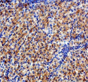 Zebrafish DIO3 Antibody Liver IHC. Immunohistochemical analysis of paraffin-embedded zebrafish liver tissue using Zebrafish DIO3 Antibody / Iodothyronine Deiodinase 3 Antibody demonstrates widespread cytoplasmic HRP-DAB brown staining throughout hepatocyte populations. The staining pattern is consistent with expression of DIO3A, a thyroid hormone-inactivating enzyme that regulates local concentrations of triiodothyronine (T3) and thyroxine (T4) to maintain endocrine homeostasis. Positive immunoreactivity within hepatic tissue highlights the important role of DIO3A in thyroid hormone metabolism, developmental regulation, and control of tissue-specific endocrine signaling. Heat-induced antigen retrieval was performed in EDTA buffer. Tissue sections were blocked with 10% goat serum and incubated with DIO3A antibody (2 ug/ml) overnight at 4Â°C, followed by Peroxidase Conjugated Goat Anti-rabbit IgG and DAB chromogen detection.