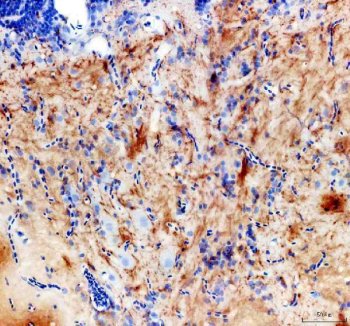 Zebrafish FZD3 Antibody Brain IHC. Immunohistochemical analysis of FZD3A expression in paraffin-embedded zebrafish brain tissue using Zebrafish FZD3 Antibody / Frizzled 3 Antibody. Specific staining is observed within neural tissue, consistent with the known role of FZD3A in Wnt signaling and nervous system development. Heat-mediated antigen retrieval was performed in EDTA buffer prior to staining. Sections were blocked with 10% goat serum and incubated overnight at 4Â°C with rabbit anti-FZD3A antibody (2 ug/ml). Detection was performed using a peroxidase-conjugated goat anti-rabbit IgG secondary antibody followed by DAB chromogen development.
