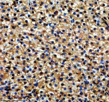 Zebrafish DMPK Antibody Liver IHC. Immunohistochemical analysis of paraffin-embedded zebrafish liver tissue using Zebrafish DMPK Antibody / Myotonic Dystrophy Protein Kinase Antibody demonstrates widespread cytoplasmic staining throughout hepatocellular populations. DMPK is a serine/threonine protein kinase involved in cytoskeletal organization, intracellular signaling, and muscle-associated cellular regulatory pathways. The observed staining pattern is consistent with endogenous DMPK expression and supports the utility of this antibody for immunohistochemical detection of DMPK in zebrafish tissues. Heat-mediated antigen retrieval was performed in EDTA buffer. The tissue section was blocked with 10% goat serum and incubated overnight at 4Â°C with rabbit anti-DMPK antibody (2 ug/ml). Detection was performed using a peroxidase-conjugated goat anti-rabbit IgG secondary antibody followed by DAB chromogen development.