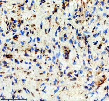 Zebrafish DMPK Antibody Heart IHC. Immunohistochemical analysis of paraffin-embedded zebrafish heart tissue using Zebrafish DMPK Antibody / Myotonic Dystrophy Protein Kinase Antibody demonstrates cytoplasmic staining within cardiomyocytes and associated cardiac tissue structures. DMPK is a serine/threonine protein kinase involved in muscle function, cytoskeletal regulation, and intracellular signaling pathways that contribute to normal cardiac and skeletal muscle physiology. The observed staining pattern is consistent with endogenous DMPK expression and supports the utility of this antibody for immunohistochemical detection of DMPK in zebrafish tissues. Heat-mediated antigen retrieval was performed in EDTA buffer. The tissue section was blocked with 10% goat serum and incubated overnight at 4Â°C with rabbit anti-DMPK antibody (2 ug/ml). Detection was performed using a peroxidase-conjugated goat anti-rabbit IgG secondary antibody followed by DAB chromogen development.