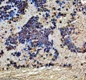 Zebrafish DMPK Antibody Brain IHC. Immunohistochemical analysis of paraffin-embedded zebrafish brain tissue using Zebrafish DMPK Antibody / Myotonic Dystrophy Protein Kinase Antibody demonstrates cytoplasmic staining within neuronal and neuropil-rich regions. DMPK is a serine/threonine protein kinase involved in cytoskeletal organization, intracellular signaling, and the regulation of cellular architecture in muscle and neural tissues. The observed staining pattern is consistent with endogenous DMPK expression and supports the utility of this antibody for immunohistochemical detection of DMPK in zebrafish tissues. Heat-mediated antigen retrieval was performed in EDTA buffer. The tissue section was blocked with 10% goat serum and incubated overnight at 4Â°C with rabbit anti-DMPK antibody (2 ug/ml). Detection was performed using a peroxidase-conjugated goat anti-rabbit IgG secondary antibody followed by DAB chromogen development.
