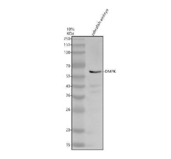 Zebrafish DMPK Antibody Embryo WB. Western blot analysis of zebrafish embryo tissue lysate using Zebrafish DMPK Antibody / Myotonic Dystrophy Protein Kinase Antibody demonstrates a distinct immunoreactive band at approximately 67 kDa, consistent with the expected molecular weight of DMPK. DMPK is a serine/threonine protein kinase involved in muscle development, cytoskeletal organization, and intracellular signaling pathways that regulate cellular architecture and contractile tissue function. The observed banding pattern is consistent with endogenous DMPK expression in zebrafish embryonic tissue and supports the utility of this antibody for western blot detection of DMPK.