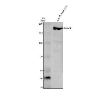 Zebrafish DNMT1 Antibody WB. Western blot analysis of DNMT1 using anti-DNMT1 antibody demonstrates a distinct immunoreactive band at approximately 169 kDa in zebrafish embryo lysate, consistent with the expected molecular weight of DNA Methyltransferase 1 (DNMT1). DNMT1 is a key epigenetic regulation enzyme responsible for maintenance of genomic DNA methylation patterns during DNA replication and cellular division. The observed expression in zebrafish embryo tissue is consistent with the essential role of DNMT1 in vertebrate development, genome stability, and epigenetic inheritance. Western blot was performed using 0.5 ug/ml primary antibody. Predicted molecular weight: ~169 kDa.