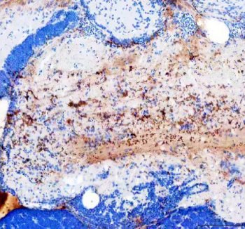 Zebrafish MMP19 Antibody Brain IHC. Immunohistochemistry staining of paraffin-embedded zebrafish brain tissue using MMP19 antibody demonstrates prominent staining within neural tissue compartments, consistent with expression of Matrix Metalloproteinase 19 (MMP19). MMP19 is an extracellular matrix remodeling enzyme that regulates matrix turnover, tissue organization, and cellular interactions within the local microenvironment. The observed staining pattern is consistent with the established role of matrix metalloproteinases in tissue remodeling, developmental morphogenesis, and maintenance of extracellular matrix architecture during vertebrate development. Heat-mediated antigen retrieval was performed in EDTA buffer. Tissue sections were stained with 2 ug/ml primary antibody and visualized using DAB chromogen.