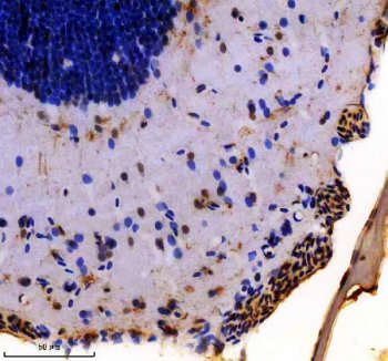 Zebrafish VHL Antibody Brain IHC. Immunohistochemistry staining of paraffin-embedded zebrafish brain tissue using VHL antibody demonstrates distinct staining within neural tissue compartments and cells lining peripheral brain structures, consistent with expression of Von Hippel-Lindau protein (VHL). VHL is a key regulator of hypoxia-responsive signaling pathways that controls the stability of hypoxia-inducible factor (HIF) proteins and helps coordinate cellular responses to oxygen availability. The observed staining pattern is consistent with the established role of VHL in oxygen sensing, developmental regulation, and maintenance of cellular homeostasis within vertebrate tissues. Heat-mediated antigen retrieval was performed in EDTA buffer. Tissue sections were stained with 2 ug/ml primary antibody and visualized using DAB chromogen.