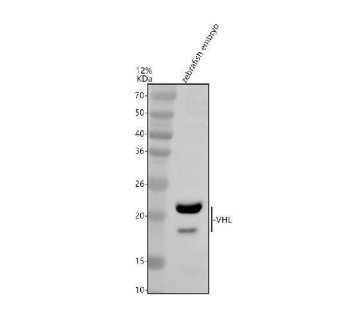 Zebrafish VHL Antibody WB. Western blot analysis of VHL using anti-VHL antibody demonstrates a distinct immunoreactive band at approximately 18-24 kDa in zebrafish embryo lysate, consistent with the expected molecular weight range of Von Hippel-Lindau protein (VHL). VHL is a conserved regulator of hypoxia-responsive signaling pathways that controls the stability of hypoxia-inducible factor (HIF) proteins and coordinates cellular adaptation to oxygen availability. The observed expression in embryonic tissue is consistent with the important role of VHL in developmental regulation, vascular formation, oxygen sensing, and maintenance of cellular homeostasis during vertebrate development. Western blot was performed using 0.5 ug/ml primary antibody. Predicted molecular weight: ~18 kDa.