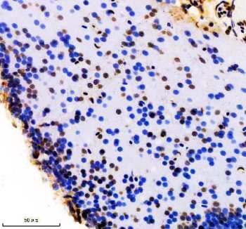 Zebrafish FOXD1 Antibody Brain IHC. Immunohistochemistry staining of paraffin-embedded zebrafish brain tissue using FOXD1 antibody demonstrates prominent nuclear staining within neural cell populations, consistent with expression of Forkhead Box Protein D1 (FOXD1). FOXD1 is a developmental transcription factor that regulates gene expression programs involved in tissue patterning, cellular differentiation, and regional specification during vertebrate development. The observed nuclear localization is consistent with the role of FOXD1 as a DNA-binding transcriptional regulator and supports its involvement in developmental processes governing nervous system organization and maturation. Heat-mediated antigen retrieval was performed in EDTA buffer. Tissue sections were stained with 2 ug/ml primary antibody and visualized using DAB chromogen.