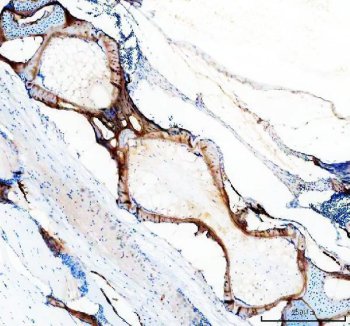 Zebrafish COL10A1 Antibody IHC. Immunohistochemistry analysis of COL10A1A using anti-COL10A1 antibody. COL10A1A was detected in a paraffin-embedded section of zebrafish vertebra tissue. Heat mediated antigen retrieval was performed in EDTA buffer. The tissue section was blocked with 10% goat serum. The tissue section was then incubated with 2 ug/ml rabbit anti-COL10A1A Antibody overnight at 4oC. Peroxidase Conjugated Goat Anti-rabbit IgG was used as secondary antibody and incubated for 30 minutes at 37oC. The tissue section was developed using DAB as the chromogen.