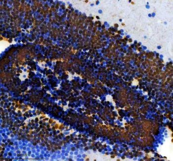 Zebrafish FOXE3 Antibody Brain IHC. Immunohistochemistry staining of paraffin-embedded zebrafish brain tissue using FOXE3 antibody demonstrates strong nuclear staining throughout densely packed neural cell populations, consistent with expression of Forkhead Box Protein E3 (FOXE3). FOXE3 is a developmental transcription factor that regulates gene expression programs involved in cellular differentiation, tissue specification, and maintenance of developmental regulatory networks. The observed nuclear localization is consistent with the role of FOXE3 as a DNA-binding transcriptional regulator and supports its involvement in developmental processes governing vertebrate nervous system organization and cellular identity. Heat-mediated antigen retrieval was performed in EDTA buffer. Tissue sections were stained with 2 ug/ml primary antibody and visualized using DAB chromogen.