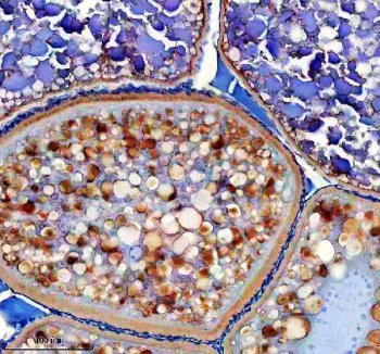 Zebrafish MC4R Antibody Ovary IHC. Immunohistochemistry staining of paraffin-embedded zebrafish ovary tissue using MC4R antibody demonstrates widespread cytoplasmic and membranous staining throughout oocyte-associated cellular compartments, consistent with expression of Melanocortin Receptor 4 (MC4R). MC4R is a G protein-coupled receptor that mediates melanocortin signaling pathways involved in neuroendocrine communication, energy homeostasis, and hormonal regulation. The observed staining pattern within ovarian tissue is consistent with the established role of melanocortin signaling in coordinating endocrine functions and reproductive physiology in vertebrates. Heat-mediated antigen retrieval was performed in EDTA buffer. Tissue sections were stained with 2 ug/ml primary antibody and visualized using DAB chromogen.