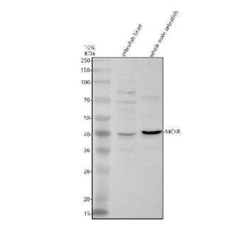 Zebrafish MC4R Antibody WB. Western blot analysis of MC4R using anti-MC4R antibody demonstrates a distinct immunoreactive band at approximately 40 kDa in zebrafish head and whole male tissue lysates, consistent with expression of Melanocortin Receptor 4 (MC4R). MC4R is a G protein-coupled receptor that mediates melanocortin signaling pathways involved in neuroendocrine communication, energy homeostasis, feeding regulation, and hormonal control. The observed expression in neural and whole-body tissues is consistent with the established role of MC4R in coordinating physiologic responses through conserved endocrine and neuronal signaling networks. Western blot was performed using 0.5 ug/ml primary antibody. Predicted molecular weight: ~36 kDa.