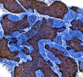 Zebrafish IGF3 Antibody Testis IHC. Immunohistochemistry staining of paraffin-embedded zebrafish testis tissue using IGF3 antibody demonstrates widespread cytoplasmic staining throughout seminiferous tissue compartments, consistent with expression of Insulin-like Growth Factor 3 (IGF3). IGF3 is a secreted growth factor that belongs to the insulin-like growth factor family and plays important roles in reproductive biology, gonadal development, cellular differentiation, and endocrine signaling. The observed staining pattern within testicular tissue is consistent with the established role of IGF3 in regulating reproductive maturation and growth factor-mediated communication within the vertebrate reproductive system. Heat-mediated antigen retrieval was performed in EDTA buffer. Tissue sections were stained with 2 ug/ml primary antibody and visualized using DAB chromogen.