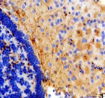 Zebrafish KISS2 Antibody Brain IHC. Immunohistochemistry staining of paraffin-embedded zebrafish brain tissue using KISS2 antibody demonstrates widespread cytoplasmic staining within neuronal cell populations, consistent with expression of Kisspeptin 2 (KISS2). KISS2 is a neuroendocrine signaling peptide that participates in reproductive regulation, hormonal communication, and coordination of endocrine pathways. The observed staining pattern within neural tissue is consistent with the established role of kisspeptin family members in integrating neuronal and endocrine signaling networks that regulate reproductive physiology, developmental timing, and vertebrate homeostasis. Heat-mediated antigen retrieval was performed in EDTA buffer. Tissue sections were stained with 2 ug/ml primary antibody and visualized using DAB chromogen.