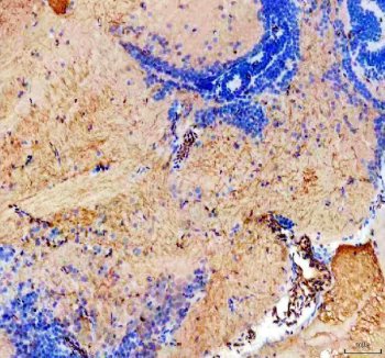 Zebrafish KISS2 Antibody Brain IHC. Immunohistochemistry staining of paraffin-embedded zebrafish brain tissue using KISS2 antibody demonstrates diffuse cytoplasmic staining throughout multiple neural regions, consistent with expression of Kisspeptin 2 (KISS2). KISS2 is a neuroendocrine signaling peptide that plays an important role in coordinating reproductive physiology, endocrine communication, and hormone-dependent regulatory pathways. The broad distribution observed within brain tissue is consistent with the established function of kisspeptin family members in integrating neuronal and endocrine signals that influence reproductive maturation, developmental processes, and physiologic homeostasis. Heat-mediated antigen retrieval was performed in EDTA buffer. Tissue sections were stained with 2 ug/ml primary antibody and visualized using DAB chromogen.
