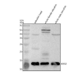 Zebrafish KISS2 Antibody WB. Western blot analysis of KISS2 using anti-KISS2 antibody demonstrates a prominent immunoreactive band at approximately 14-15 kDa in zebrafish head, whole female, and whole male tissue lysates, consistent with the expected molecular weight of Kisspeptin 2 (KISS2). KISS2 is a neuroendocrine signaling peptide that regulates reproductive physiology, endocrine communication, and hormone-dependent developmental pathways. The observed expression across neural and whole-body tissue samples is consistent with the established role of kisspeptin family members in coordinating reproductive signaling networks and integrating neuronal and endocrine regulatory mechanisms in vertebrates. Western blot was performed using 0.5 ug/ml primary antibody. Predicted molecular weight: ~15 kDa.