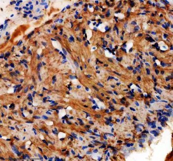 Zebrafish DAPK2A Antibody Heart IHC. Immunohistochemistry staining of paraffin-embedded zebrafish heart tissue using DAPK2A antibody demonstrates widespread cytoplasmic staining throughout cardiomyocyte-rich regions, consistent with expression of Death Associated Protein Kinase 2a (DAPK2A). DAPK2A is a calcium/calmodulin-regulated serine/threonine kinase that participates in signaling pathways governing cellular regulation, stress responses, and programmed cell fate decisions. The observed staining pattern within cardiac tissue is consistent with the role of DAPK family proteins in coordinating intracellular signaling networks that support tissue homeostasis, cellular adaptation, and maintenance of normal physiologic function. Heat-mediated antigen retrieval was performed in EDTA buffer. Tissue sections were stained with 2 ug/ml primary antibody and visualized using DAB chromogen.