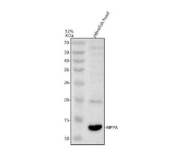 Zebrafish NPPA Antibody WB. Western blot analysis of NPPA using anti-NPPA antibody demonstrates a distinct immunoreactive band at approximately 15 kDa in zebrafish head tissue lysate, consistent with the expected molecular weight of Natriuretic Peptide A (NPPA). NPPA is the precursor of atrial natriuretic peptide (ANP), a peptide hormone that functions as an important regulator of cardiovascular physiology, fluid balance, and endocrine signaling. The observed expression is consistent with the established role of natriuretic peptide pathways in cardiovascular regulation and vertebrate homeostasis. Western blot was performed using 0.5 ug/ml primary antibody. Predicted molecular weight: ~15 kDa.