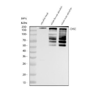 Zebrafish DSE Antibody WB. Western blot analysis of DSE expression using anti-DSE antibody. DSE, also known as Dermatan Sulfate Epimerase, is an extracellular matrix biosynthetic enzyme that catalyzes the conversion of glucuronic acid to iduronic acid during dermatan sulfate synthesis. Lane 1: whole female zebrafish tissue lysate. Lane 2: whole male zebrafish tissue lysate. A major band was detected at approximately 180 kDa, above the predicted molecular weight of 110 kDa. Additional bands between approximately 55 and 90 kDa were also observed and may represent proteolytic fragments, alternatively processed forms, or post translationally modified species of Dermatan Sulfate Epimerase. The slower migration of the major band may reflect extensive glycosylation or other post translational modifications. These results demonstrate expression of DSE in adult zebrafish tissues and support the utility of this antibody for studies of extracellular matrix biology, glycosaminoglycan metabolism, and connective tissue development.